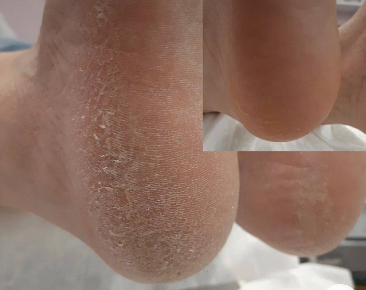 نمونه کار پدیکور 10